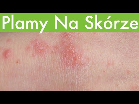 Co do picia z silnym wypadaniu włosów Oznacza aby poprawić wygląd włosów