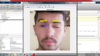 matlab based eye controlled wheelchair  |ieee best final year projects