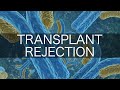 Transplant Rejection