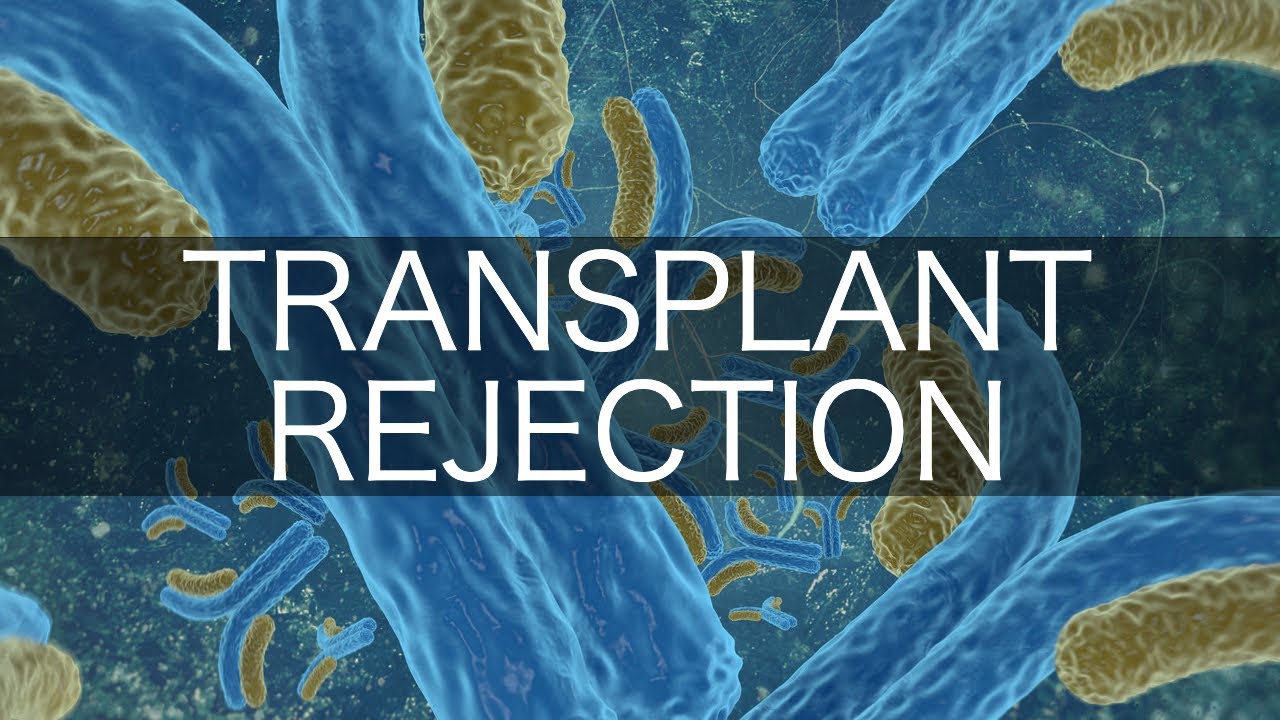 Transplant Rejection