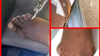WATCH HOW PEOPLE CUT THEIR TOE for 1CAR and MONEY