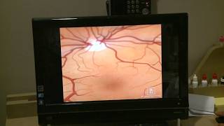 Hospitals warn patients of MyChart scam, which drug might risk increase for glaucoma and dating app