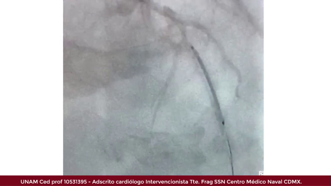 Marcelo Utrera Lagunas-101