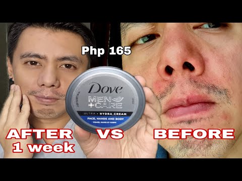 3 CORRECT TIPS | DOVE MEN+CARE ULTRA HYDRA MOISTURIZING WHITENING CREAM FOR ACNE & SCARS REVIEW