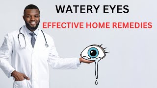 What Causes Watery Eyes | Effective Home Remedies For Watery Eyes!