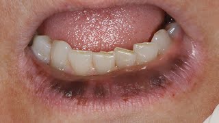 Bizarre Lip Pigmentation Case: Dr. Nemeth