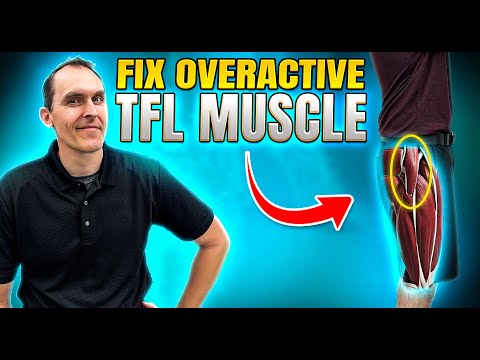 How To Fix An Overactive TFL Muscle - (Low Back, Hip, Knee Issues)
