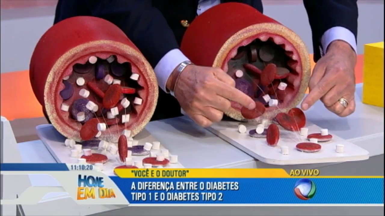 Você e o Doutor tira dúvidas sobre a diabetes