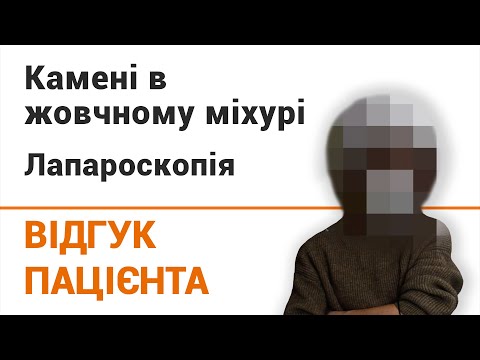 Холецистит: симптомы, причины, лечение | Клиника "Добрый прогноз" - фото 7