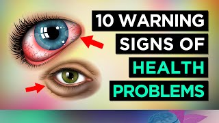 10 Warning Signs Your EYES are TELLING YOU About Your HEALTH.