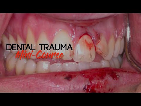 Dental Trauma Mini-Course - Part 3 - Dental Trauma Guide - Introduction