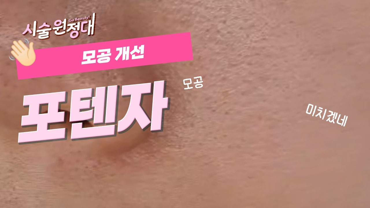related_video_thumbnail