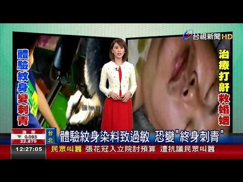 體驗紋身染料致過敏 恐變終身刺青