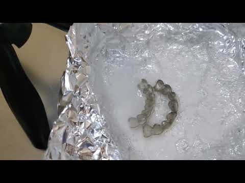 How to remove tarnish from Silver/Gold Grillz