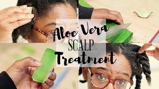 HOW TO STOP DRY SCALP & DANDRUFF  | Aloe Vera Scalp Treatment