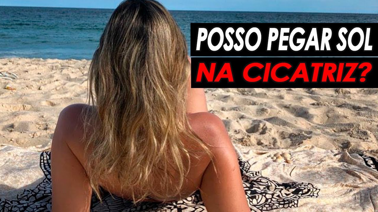 POSSO PEGAR SOL NA MINHA CICATRIZ