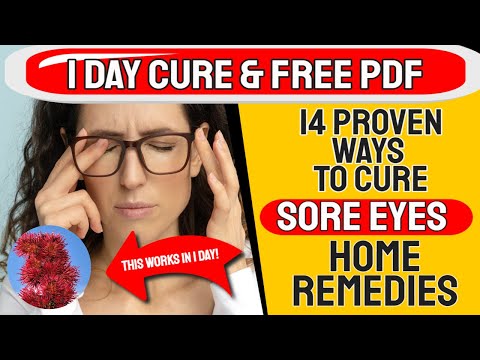 , title : '1 Day Cure With This Natural Oil 🧴 14 NATURAL REMEDY FOR SORE EYES 👁️ Natural Remedy For SORE EYES👁️'