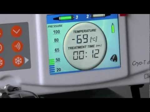 Cryostimulation CRYO-T duo.mov