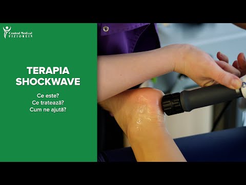 Terapia shockwave-Centrul Medical Fiziorein