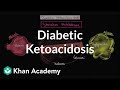Acute complications of diabetes - Diabetic ketoacidosis | NCLEX-RN | Khan Academy