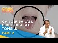 Cancer sa Labi, Bibig, Dila, at Tonsils (Part 2) | Usapang Pangkalusugan