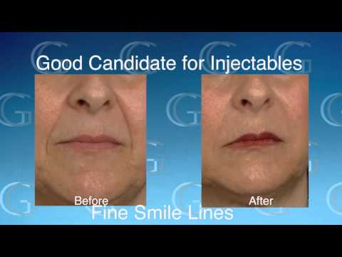 Injectables vs. Fat Transfer