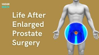 Life After Enlarged Prostate Surgery