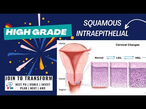 HSIL - High grade squamous intraepithelial lesion