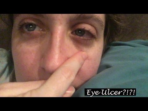 I HAD AN EYE ULCER!!! | Vlogmas 2016 DCP