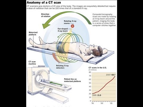 How CT Scan Machine Works