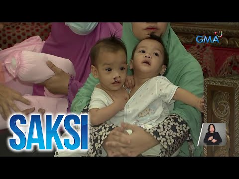 Conjoined twins mula Panabo City, paooperahan nang libre ng gobyerno ng Saudi Arabia Saksi