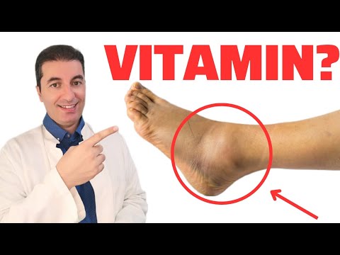 , title : 'Najvažniji vitamin za uklanjanje oteklina ruku,nogu,stopala'