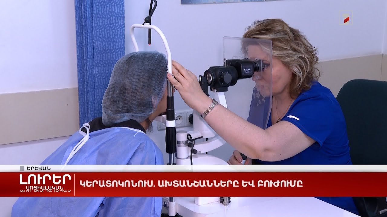 Կերատոկոնուս. ախտանշանները և բուժումը