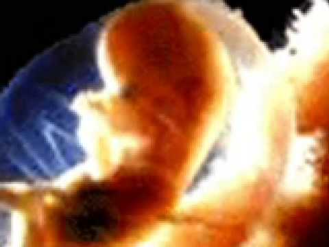 Click to Watch the Is A Vote For An Anti-Life Political Candidate Morally Defensible? video Click to Watch the Is A Vote For An Anti-Life Political Candidate Morally Defensible? video