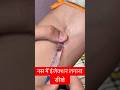 नस में इंजेक्शन लगाना सीखे Injection Vein Cannula Cannul