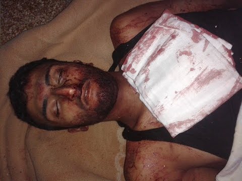 لحظة إصابة  محمود مخباط أثناء اشتباكات في منطقة جنوب دمشق