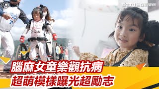 做什麼都吃力！腦麻女童超萌模樣曝光超勵志