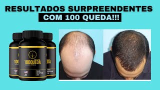 Chega de Sofrer com Calvcie e Queda de Cabelo Com 100 QUEDA - 100 QUEDA CAPS ORIGINAL BENEFCIOS