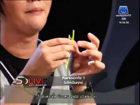 ภาพอาการฝ่าเท้าโรคสะเก็ดเงิน เคียฟสถาบันของโรคสะเก็ดเงิน