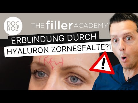 GEFAHR ERBLINDUNG HYALURON ZORNESFALTE – die Danger Zone 💣 erklärt von Dr. Rolf Bartsch