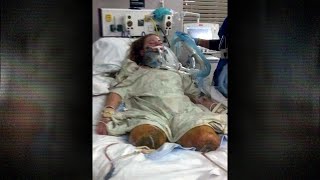 Drs. Exclusive - I Survived Being Run over By a Train