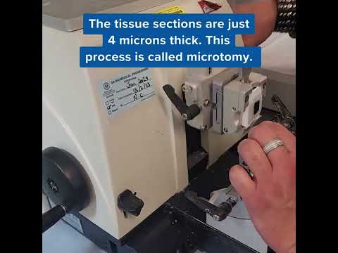 LABS UNLOCKED 🔑 Take a tour of our Anatomical Pathology laboratory at Frome Road