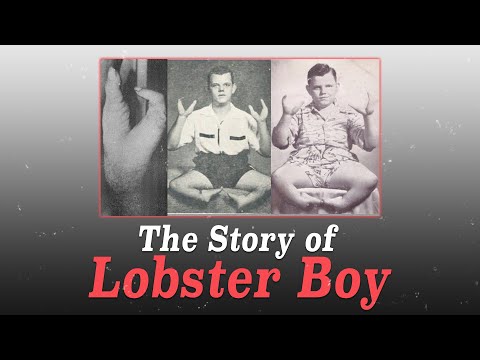 How the Infamous 'Lobster Boy' turned into a MURDERER...