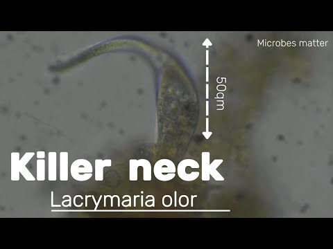 Lacrymaria olor - a single celled organism, seen under the microscope.