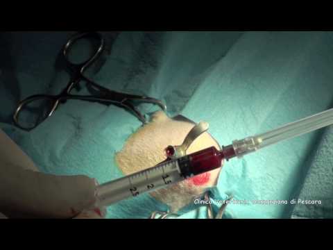 Immagine caviglia osteoartrite Un mal di schiena in mattinata vi