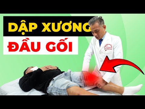 Bao lâu DẬP XƯƠNG GỐI mới khỏi? Đừng để bạn “mất Tết” chỉ vì CHỦ QUAN!