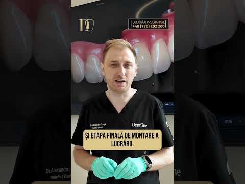 Pașii pentru o dantură fixă pe implanturi dentare