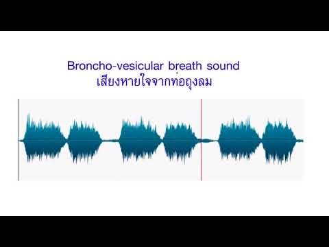 broncho vesicular breath sound