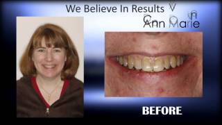 preview picture of video 'Best Cosmetic Dentist Wellesley Mind Blowing results Call today 781.772.1646'