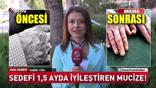 Sedefi bir buçuk ayda iyileştiren mucize!